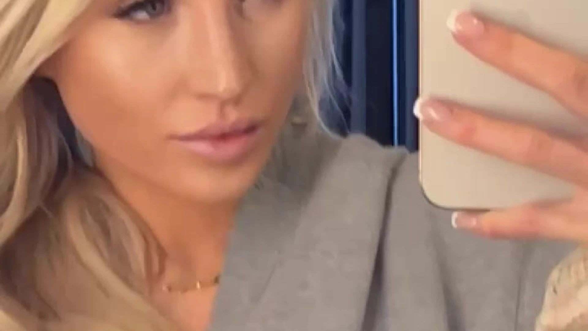 white lolosgonewild leaked nudes Exclusive vid full