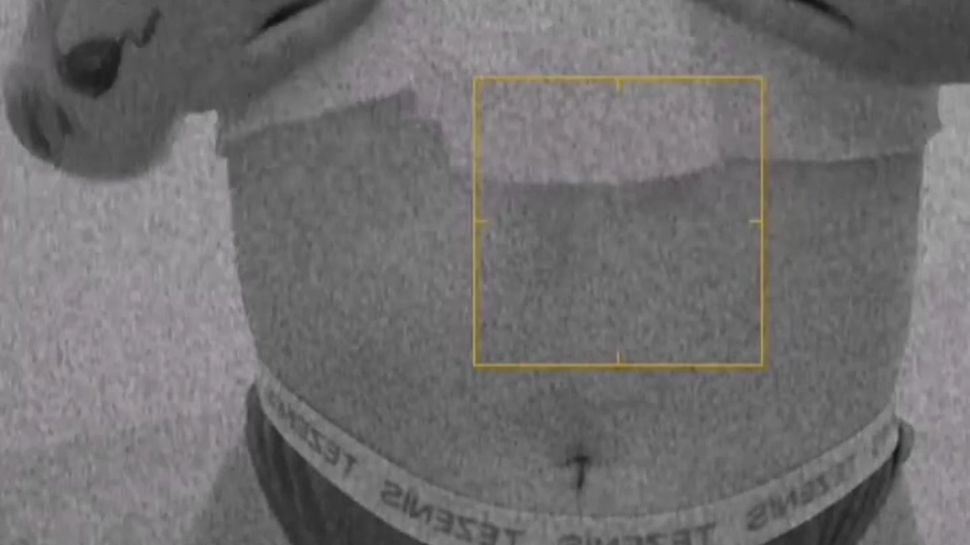 Exposed Silicone Tits Mia Yokai onlyfans